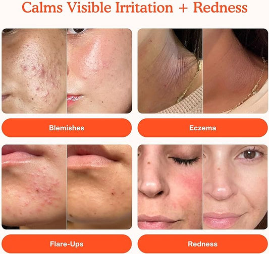 Tower 28 SOS Daily Rescue Facial Spray | Soothing and Refreshing pH Balancing Toner | Hypochlorous Acid Designed for Sensitive Skin | 4 Fl Oz