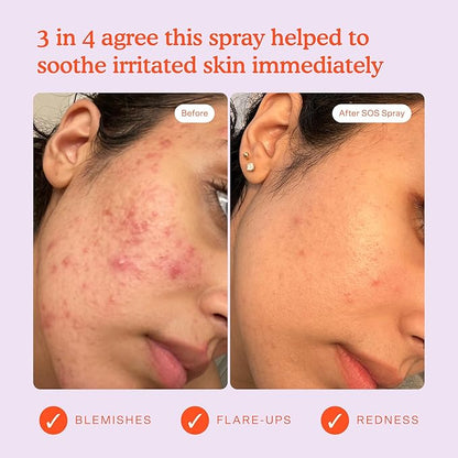 Tower 28 SOS Daily Rescue Facial Spray | Soothing and Refreshing pH Balancing Toner | Hypochlorous Acid Designed for Sensitive Skin | 4 Fl Oz